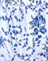Cadena de flores azules